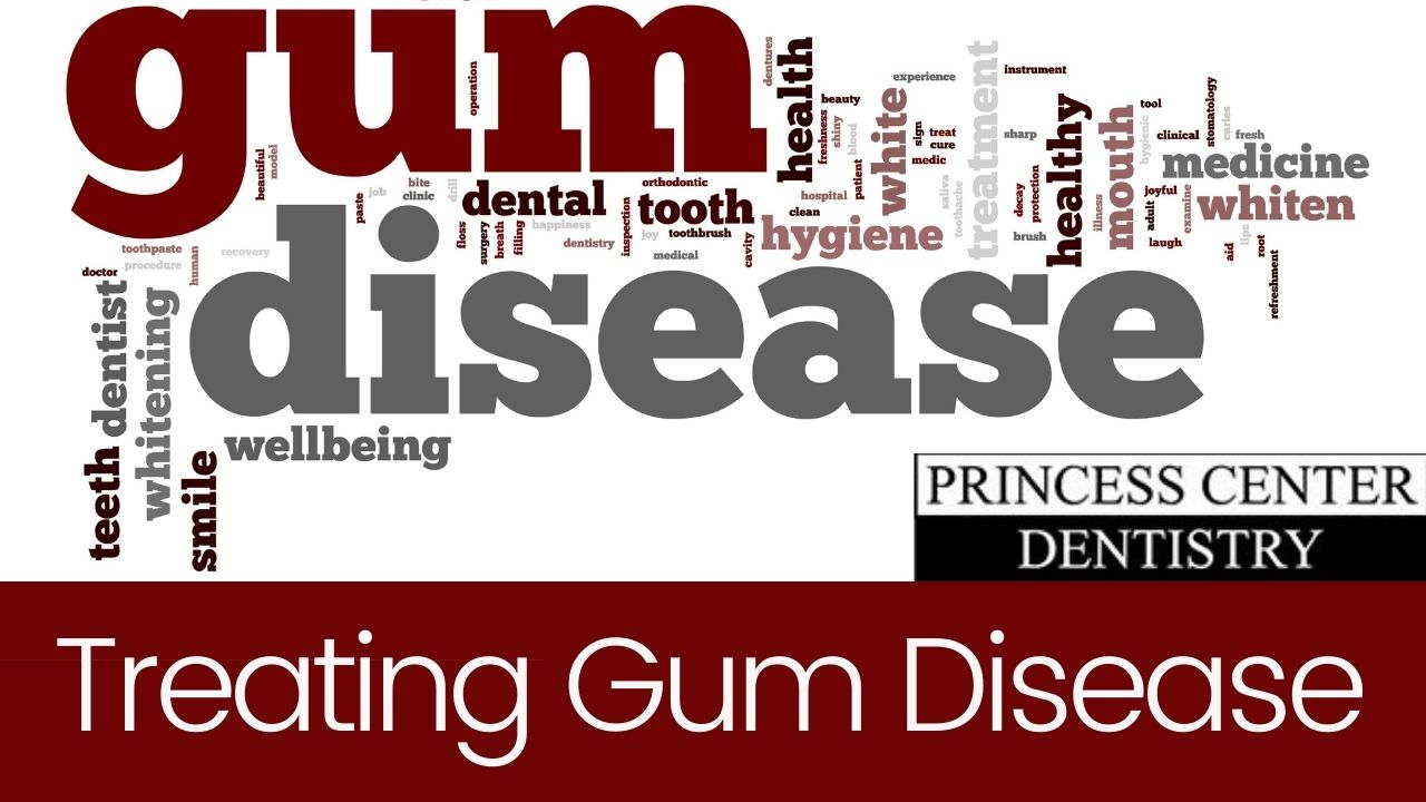 words related to gum disease
